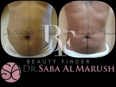 Dr. Saba Almarush Abu Dhabi, top Plastic Surgery from Abu Dhabi, Beauty Finder - 2