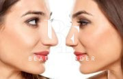 Dr. Surindher Aesthetic and Plastic Surgery, top Plastic Surgery from Abu Dhabi, Beauty Finder - 10