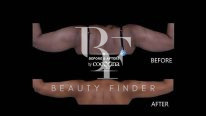 Dr. Sanjay Parashar, top Plastic Surgery from Dubai, Beauty Finder - 10