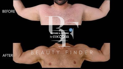 Dr. Sanjay Parashar, top Plastic Surgery from Dubai, Beauty Finder - 11