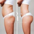 Tarmeem Plastic Surgery  Abu Dhabi, top Plastic Surgery from Abu Dhabi, Beauty Finder - 4