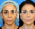 Dr. Yamen Almeghawesh  Abu Dhabi, top Plastic Surgery from Abu Dhabi, Beauty Finder - 3