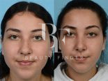 Dermaplast at Dr. Tariq Hospital, top Plastic Surgery from Bahrain, Beauty Finder - 7