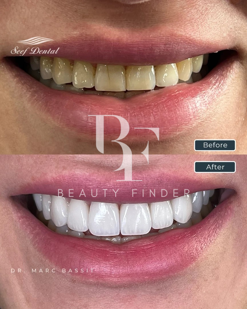 Seef Dental, top Dentist from Bahrain, Beauty Finder - 1