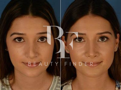 Plastic Surgery at Muscat Private Hospital, top Plastic Surgery from Oman, Beauty Finder - 7